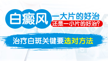 白癜风给患者带来了什么危害?